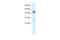 Cholinergic Receptor Nicotinic Alpha 3 Subunit antibody, 31-092, ProSci, Western Blot image 