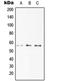 TNF Receptor Superfamily Member 10a antibody, LS-C353105, Lifespan Biosciences, Western Blot image 