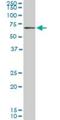 Carnitine O-Octanoyltransferase antibody, H00054677-M01, Novus Biologicals, Western Blot image 