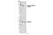 ALK Receptor Tyrosine Kinase antibody, 4143S, Cell Signaling Technology, Western Blot image 