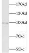 MCC Regulator Of WNT Signaling Pathway antibody, FNab05046, FineTest, Western Blot image 