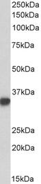 Frizzled Class Receptor 4 antibody, 43-611, ProSci, Enzyme Linked Immunosorbent Assay image 