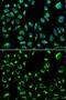 Protein Phosphatase 4 Catalytic Subunit antibody, GTX55756, GeneTex, Immunofluorescence image 