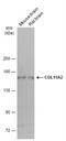 Collagen Type XI Alpha 2 Chain antibody, NBP2-43809, Novus Biologicals, Western Blot image 