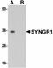Synaptogyrin-1 antibody, orb94358, Biorbyt, Western Blot image 