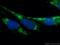 Calsequestrin 2 antibody, 18422-1-AP, Proteintech Group, Immunofluorescence image 