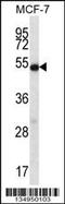 Coilin antibody, 57-958, ProSci, Western Blot image 