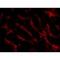 TNF Receptor Superfamily Member 12A antibody, NBP2-34499, Novus Biologicals, Immunofluorescence image 