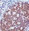 Zeta Chain Of T Cell Receptor Associated Protein Kinase 70 antibody, PA5-35140, Invitrogen Antibodies, Immunohistochemistry frozen image 