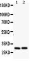 BCL2 Related Protein A1 antibody, PA2102, Boster Biological Technology, Western Blot image 