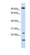 Guanylate Cyclase Activator 1A antibody, NBP1-54868, Novus Biologicals, Western Blot image 