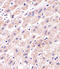 Protein Phosphatase 2 Regulatory Subunit Balpha antibody, MBS9214877, MyBioSource, Immunohistochemistry frozen image 