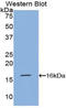 V-Set Pre-B Cell Surrogate Light Chain 1 antibody, LS-C296013, Lifespan Biosciences, Western Blot image 