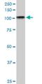 TAO Kinase 3 antibody, H00051347-M04, Novus Biologicals, Western Blot image 