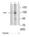 Eukaryotic Translation Initiation Factor 2 Alpha Kinase 3 antibody, ab65142, Abcam, Western Blot image 