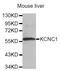 Potassium Voltage-Gated Channel Subfamily C Member 1 antibody, MBS127652, MyBioSource, Western Blot image 