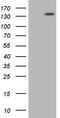 Partner And Localizer Of BRCA2 antibody, M00639, Boster Biological Technology, Western Blot image 