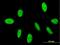 General transcription factor II-I repeat domain-containing protein 2 antibody, H00084163-B01P, Novus Biologicals, Immunofluorescence image 