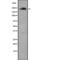 Phosphoinositide Kinase, FYVE-Type Zinc Finger Containing antibody, PA5-67981, Invitrogen Antibodies, Western Blot image 