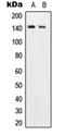 Ubiquitin Specific Peptidase 19 antibody, orb215021, Biorbyt, Western Blot image 