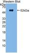 Nucleoside diphosphate kinase homolog 5 antibody, LS-C696360, Lifespan Biosciences, Western Blot image 