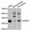 Insulin Like Growth Factor Binding Protein 1 antibody, STJ24145, St John