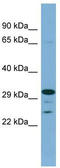 Dehydrogenase/Reductase 9 antibody, TA337615, Origene, Western Blot image 