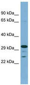 Dehydrogenase/Reductase 9 antibody, TA337615, Origene, Western Blot image 