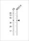 Casein Kinase 2 Alpha 1 antibody, 63-424, ProSci, Western Blot image 