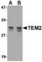 RASD Family Member 2 antibody, LS-B3212, Lifespan Biosciences, Western Blot image 