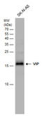 Vasoactive Intestinal Peptide antibody, GTX129999, GeneTex, Western Blot image 