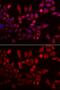 Glycogen Phosphorylase L antibody, GTX33448, GeneTex, Immunofluorescence image 