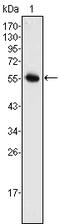 Neurogenin 3 antibody, STJ98273, St John