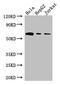 Heparanase antibody, CSB-PA010716LA01HU, Cusabio, Western Blot image 