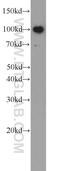 Toll Like Receptor 6 antibody, 22240-1-AP, Proteintech Group, Western Blot image 