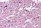 Cysteinyl Leukotriene Receptor 2 antibody, NBP1-02340, Novus Biologicals, Immunohistochemistry paraffin image 