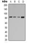 Adducin 2 antibody, LS-C413165, Lifespan Biosciences, Western Blot image 