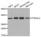 TPD52 Like 2 antibody, abx003077, Abbexa, Western Blot image 
