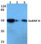 Heterogeneous Nuclear Ribonucleoprotein H2 antibody, A07741-1, Boster Biological Technology, Western Blot image 