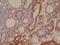 Interferon Regulatory Factor 4 antibody, M00401-1, Boster Biological Technology, Immunohistochemistry frozen image 