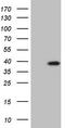 Myozenin 1 antibody, TA808903, Origene, Western Blot image 