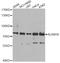AlkB Homolog 8, TRNA Methyltransferase antibody, STJ29222, St John