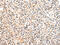 Vasohibin 1 antibody, CSB-PA899191, Cusabio, Immunohistochemistry paraffin image 