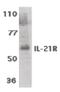 Interleukin 21 Receptor antibody, PA5-19982, Invitrogen Antibodies, Western Blot image 