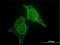 Calcium And Integrin Binding 1 antibody, H00010519-M01, Novus Biologicals, Immunocytochemistry image 