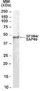 Splicing Factor 3b Subunit 4 antibody, NB100-1076, Novus Biologicals, Western Blot image 