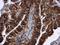C-X-C Motif Chemokine Receptor 3 antibody, GTX108145, GeneTex, Immunohistochemistry paraffin image 