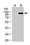 Dengue virus antibody, GTX103350, GeneTex, Western Blot image 