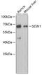 Sestrin-1 antibody, 19-062, ProSci, Western Blot image 