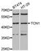 Transcobalamin-1 antibody, STJ28497, St John